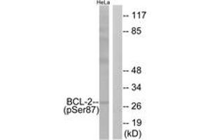 Western blot analysis of extracts from HeLa cells treated with nocodazole 1ug/ml 18h, using BCL-2 (Phospho-Ser87) Antibody. (Bcl-2 antibody  (pSer87))