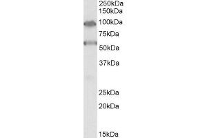 Western Blotting (WB) image for anti-TBC1 Domain Family, Member 9 (With GRAM Domain) (TBC1D9) (Internal Region) antibody (ABIN5539643)