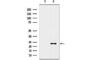 anti-Cytochrome B-245, alpha Polypeptide (CYBA) (N-Term) antibody