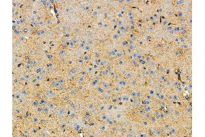 ABIN6264641 and ABIN6277740 at 1/100 staining Mouse brain tissue by IHC-P. (RAPTOR antibody  (C-Term))
