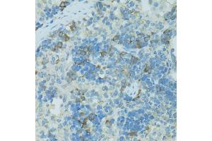 Immunohistochemistry of paraffin-embedded rat spleen using TJP2 antibody. (TJP2 antibody)