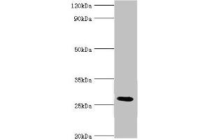 Western blot All lanes: C4b-binding protein beta chain antibody at 6 μg/mL + Mouse liver tissue Secondary Goat polyclonal to rabbit IgG at 1/10000 dilution Predicted band size: 28 kDa Observed band size: 28 kDa (C4BPB antibody  (AA 18-252))