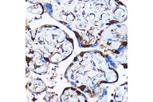 Immunohistochemistry of paraffin-embedded Human placenta using p38 MAPK Rabbit pAb (ABIN7268615) at dilution of 1:100 (40x lens). (MAPK14 antibody  (AA 1-360))
