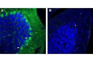 Free-floating frozen brain sections from a paraformaldehyde-perfused mouse were incubated with Anti-Plexin B1 (extracellular) Antibody (ABIN7885236, 1:300), followed by goat anti-rabbit secondary antibody conjugated to Alexa Fluor® 488 (green).