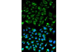 Immunofluorescence analysis of HeLa cell using PRKAR1A antibody. (PRKAR1A antibody)