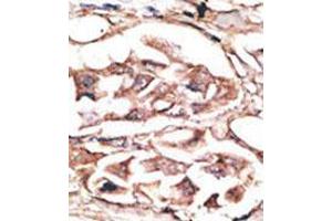 Image no. 2 for anti-Dickkopf 2 Homolog (DKK2) (C-Term) antibody (ABIN357070) (DKK2 antibody  (C-Term))