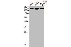 Western blot analysis of 293T Hela mouse-spleen lysis using Phospho-IRS-1 (S312) antibody. (IRS1 antibody  (pSer312))