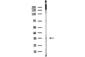 anti-beta-1,3-Glucuronyltransferase 1 (Glucuronosyltransferase P) (B3GAT1) (N-Term) antibody