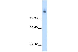 WB Suggested Anti-CPS1 Antibody Titration:  1. (CPS1 antibody  (N-Term))