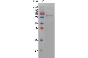 SDS-PAGE (SDS) image for Furin (Paired Basic Amino Acid Cleaving Enzyme) (FURIN) (AA 27-574) protein (His tag) (ABIN7491211)