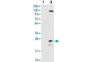 Western blot analysis of Lane 1: Negative control (vector only transfected HEK293T lysate), Lane 2: Over-expression Lysate (Co-expressed with a C-terminal myc-DDK tag (~3. (TMEM186 antibody)