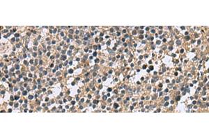 Immunohistochemistry of paraffin-embedded Human tonsil tissue using CSRP2 Polyclonal Antibody at dilution of 1:60(x200) (CSRP2 antibody)