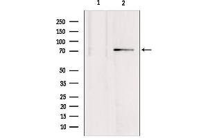 Western blot analysis of extracts from mouse brain, using MTO1 antibody. (MTO1 antibody  (N-Term))