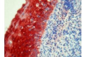 Immunohistochemistry on human tonsil paraffin sections using S100A8 antibody clone 8-5C2. (S100A8 antibody)