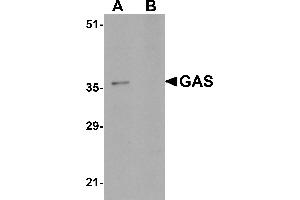 Western blot analysis of GAS in EL4 cell lysate in (A) the absence and (B) the presence of blocking peptide with GAS antibody at 1µg/mL. (Gastrin antibody  (C-Term))