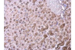 Immunohistochemistry (IHC) image for anti-Nuclear Factor I/B (NFIB) antibody (ABIN2856178)