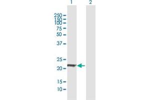 Western Blot analysis of ARL11 expression in transfected 293T cell line by ARL11 MaxPab polyclonal antibody.