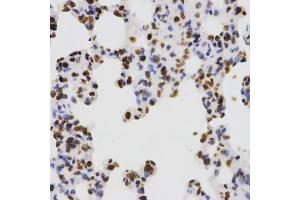 Immunohistochemistry of paraffin-embedded rat lung using DiMethyl-Histone H3-K4 antibody (ABIN1872995) at dilution of 1:200 (40x lens). (Histone 3 antibody  (H3K4me2))