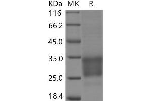 Western Blotting (WB) image for CD69 (CD69) protein (His tag,ECD) (ABIN7320165) (CD69 Protein (CD69) (His tag,ECD))