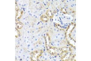 Immunohistochemistry of paraffin-embedded rat kidney using CGB7 antibody at dilution of 1:100 (x40 lens). (CGB7 antibody)