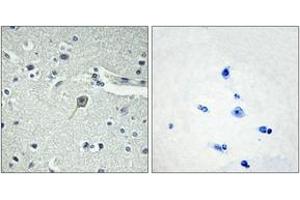 Immunohistochemistry analysis of paraffin-embedded human brain tissue, using PTHR1 Antibody. (PTH1R antibody  (AA 145-194))