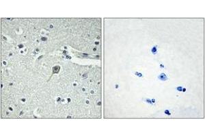 Immunohistochemistry analysis of paraffin-embedded human brain tissue, using PTHR1 Antibody. (PTH1R antibody  (AA 145-194))