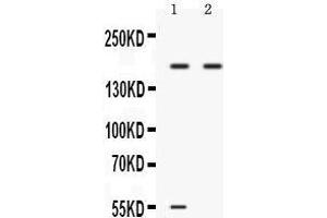 Western blot analysis of Ceruloplasmin expression in 22RV1 whole cell lysates (lane 1) and A549 whole cell lysates (lane 2). (Ceruloplasmin antibody  (AA 20-259))
