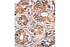 Image no. 1 for anti-Retinoblastoma 1 (RB1) (pSer780) antibody (ABIN358213) (Retinoblastoma 1 antibody  (pSer780))