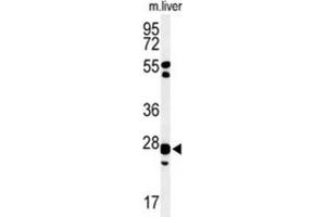 Western Blotting (WB) image for anti-Glutathione S-Transferase kappa 1 (GSTK1) antibody (ABIN3004354)