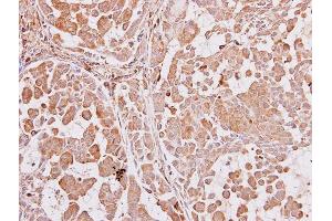 Immunohistochemistry (IHC) image for anti-Aryl Hydrocarbon Receptor Interacting Protein (AIP) antibody (ABIN2856771)