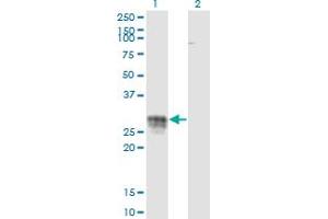 Western Blot analysis of CD83 expression in transfected 293T cell line by CD83 monoclonal antibody (M01), clone 3G10-1F4. (CD83 antibody  (AA 1-205))