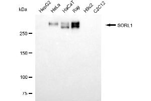 Western blotting analysis using SORL1 antibody (ABIN7800406).