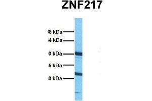 Host:  Rabbit  Target Name:  ZNF217  Sample Tissue:  Human HepG2  Antibody Dilution:  1. (ZNF217 antibody  (Middle Region))