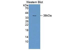 Western blot analysis of the recombinant protein. (NUP50 antibody  (AA 134-393))