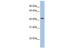 WB Suggested Anti-ZNF202  Antibody Titration: 0. (ZNF202 antibody  (Middle Region))