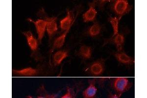 Immunofluorescence analysis of HUVEC cells using VEGF Polyclonal Antibody at dilution of 1:100 (40x lens). (VEGF antibody)