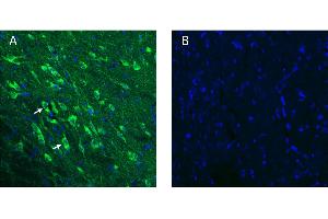 Glycine receptor β in rat substantia nigra pars compacta (SNC)A.