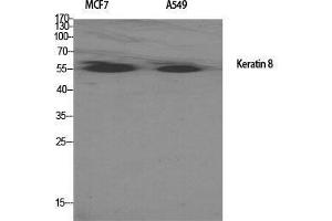 Western Blot (WB) analysis of specific cells using Cytokeratin 8 Polyclonal Antibody. (KRT8 antibody  (Ser717))