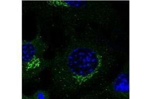 Immunostaining of macrophages With Rab14 antibody (1:50) (RAB3A antibody  (C-Term))