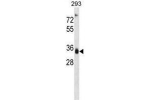 AKR1D1 Antibody (Center) western blot analysis in 293 cell line lysates (35 µg/lane). (AKR1D1 antibody  (Middle Region))