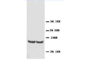 Western blot analysis of rat kidney tissue lysis using TIMP4 antibody
