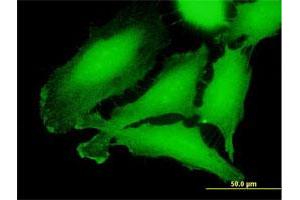 Immunofluorescence of purified MaxPab antibody to CRLF3 on HeLa cell. (CRLF3 antibody  (AA 1-442))