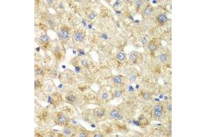 Immunohistochemistry of paraffin-embedded human liver injury using CALD1 antibody. (Caldesmon antibody  (AA 1-240))