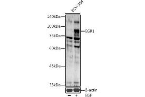 Western blot analysis of extracts of ECV-304 cells, using EGR1 antibody (ABIN6133683, ABIN6139992, ABIN7101807 and ABIN7101808) at 1:1000 dilution. (EGR1 antibody  (AA 1-250))