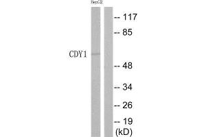 Western Blotting (WB) image for anti-Chromodomain Protein, Y-Linked, 1 (CDY1) (Internal Region) antibody (ABIN1852530) (CDY1 antibody  (Internal Region))