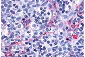 Anti-P2RY11 / P2Y11 antibody  ABIN1049204 IHC staining of human dendritic cells. (P2RY11 antibody  (Cytoplasmic Domain))