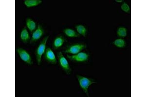 Immunofluorescent analysis of A549 cells using ABIN7143732 at dilution of 1:100 and Alexa Fluor 488-congugated AffiniPure Goat Anti-Rabbit IgG(H+L) (AAGAB antibody  (AA 191-315))