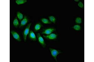 Immunofluorescent analysis of A549 cells using ABIN7143732 at dilution of 1:100 and Alexa Fluor 488-congugated AffiniPure Goat Anti-Rabbit IgG(H+L) (AAGAB antibody  (AA 191-315))