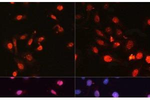 Immunofluorescence analysis of U2OS cells using Phospho-γH2A. (gamma H2AX antibody  (pSer139))
