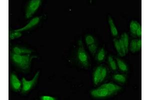 Immunofluorescent analysis of Hela cells using ABIN7169141 at dilution of 1:100 and Alexa Fluor 488-congugated AffiniPure Goat Anti-Rabbit IgG(H+L) (PIM1 antibody  (AA 25-86))
